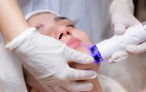 Blue Light Acne Treatment